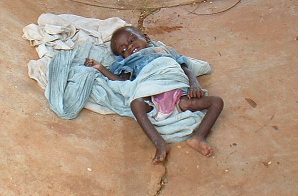 Child Cholera Victim